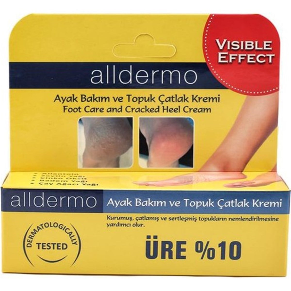 Alldermo Ayak-Topuk Bakım Kremi 60 g