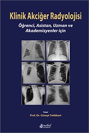 Klinik Akciğer Radyolojisi: Öğrenci, Asistan, Uzman ve Akademisyenler için