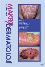 Makro Dermatoloji Eğitim Atlası