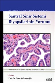Santral Sinir Sistemi Biyopsilerinin Yorumu - Biyopsi Yorumları Serisi