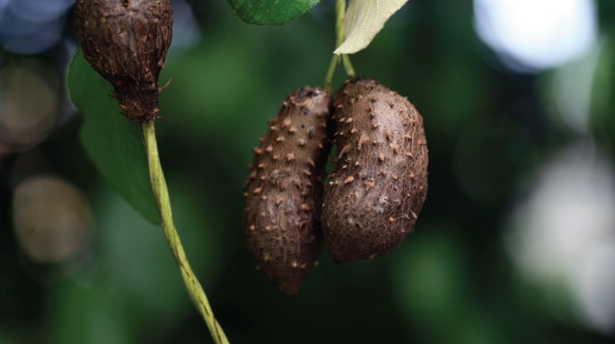 Cinsellik Sonrası Testis Ağrısı Neden Olur, Ne Yapmalı?