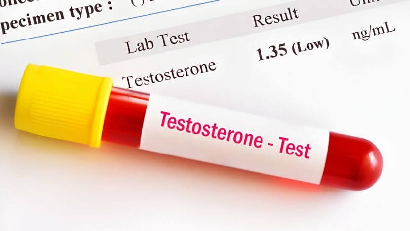 Testosteron Testi