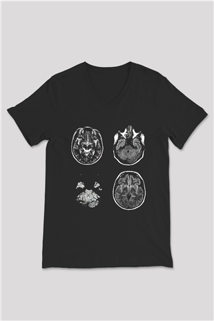 Tıp Bayramı Baskılı Unisex Siyah V Yaka Tişört - Tshirt