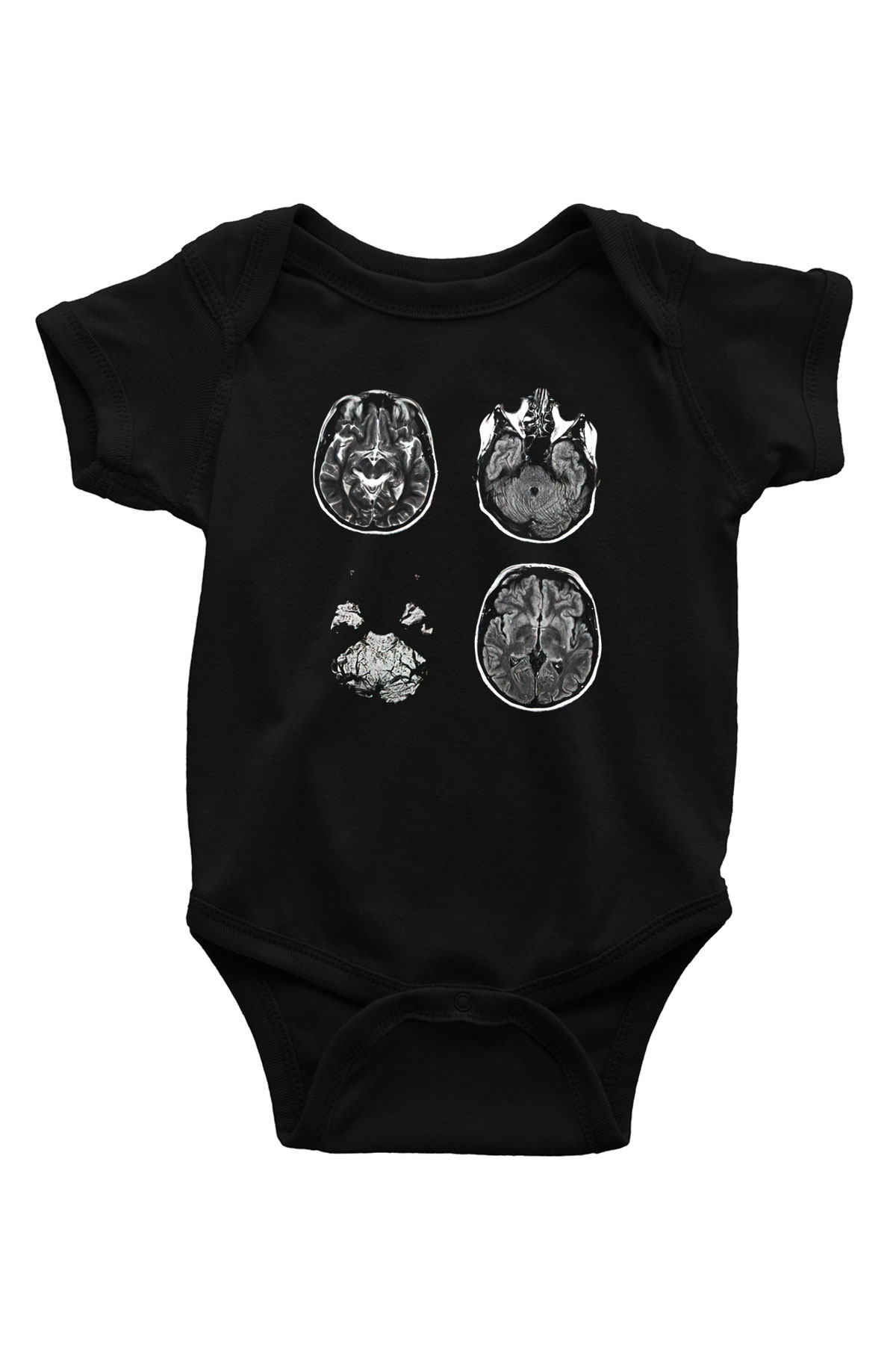Tıp Bayramı Baskılı Unisex Siyah Bebek Body - Zıbın