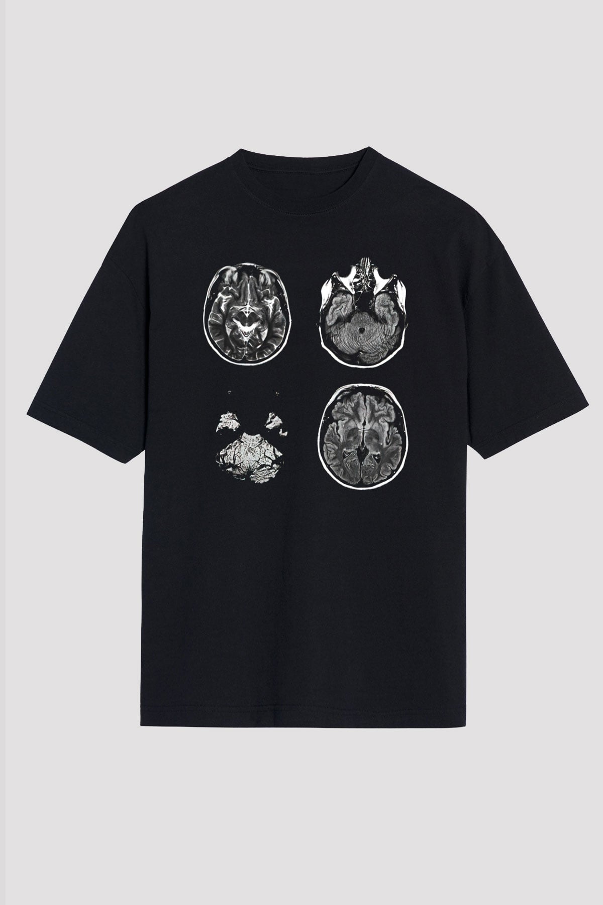 Tıp Bayramı Baskılı Unisex Siyah Oversize Tişört - Tshirt