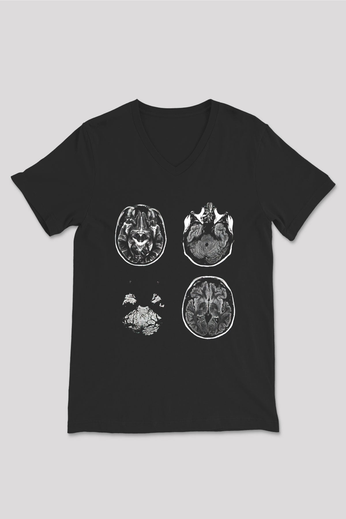 Tıp Bayramı Baskılı Unisex Siyah V Yaka Tişört - Tshirt