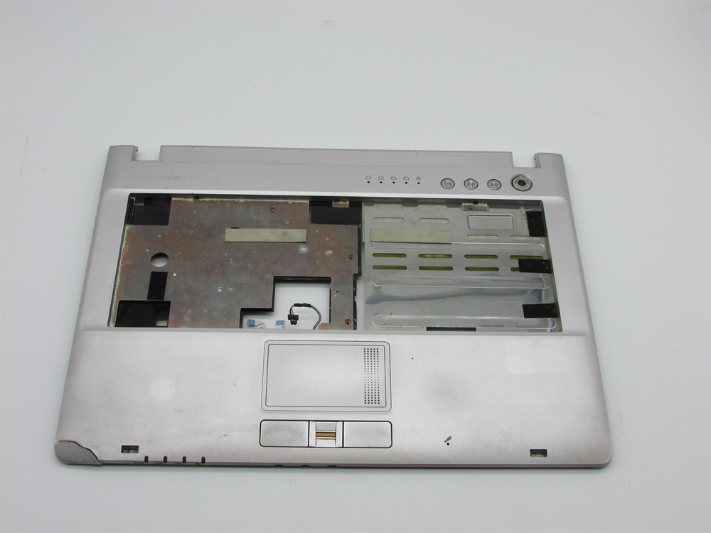WOON M72R Notebook Üst Kasa