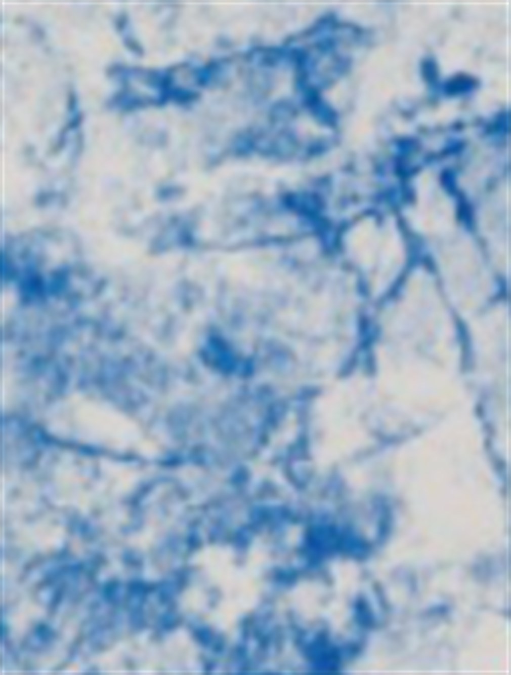 57504 SB Desenli Liner - Parlak