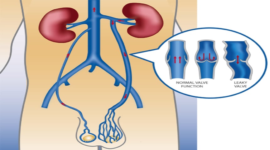 Anal jinsiy aloqa va vazelin