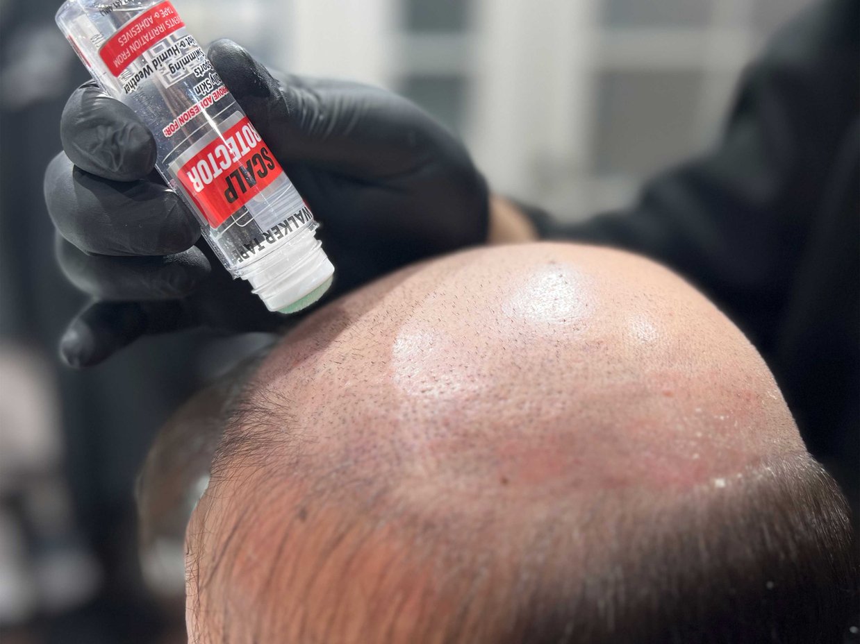 True Tape® |Scalp Protector nasıl uygulanır?