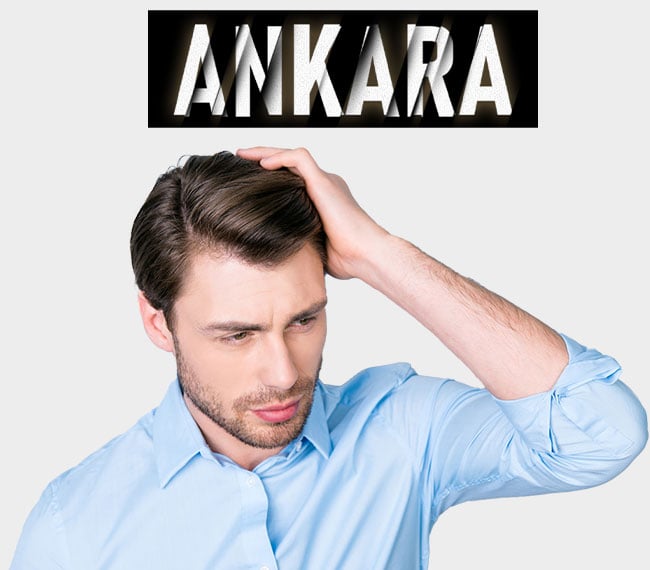 S-Well® Ankara Erkek Protez Saç Modeli