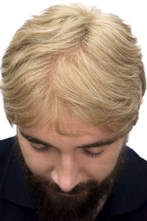 Erkek Protez Tül Peruk Kumral