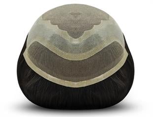 Erkek Protez Saç Modeli Smile Ankara