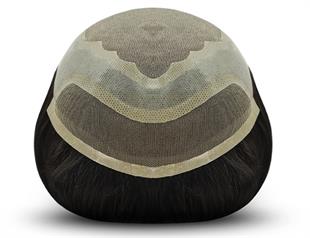 Erkek Protez Saç Modeli Smile Ankara