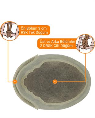 Smile Ankara Modeli Erkek Protez Saç - %100 Gerçek Saç