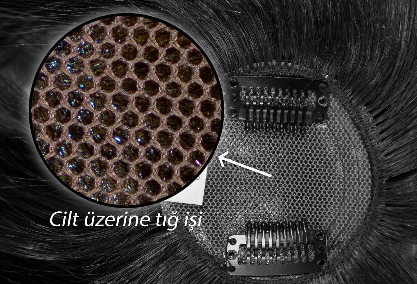 Cilt Üzerine Tığ İşi Doğal Görünüm