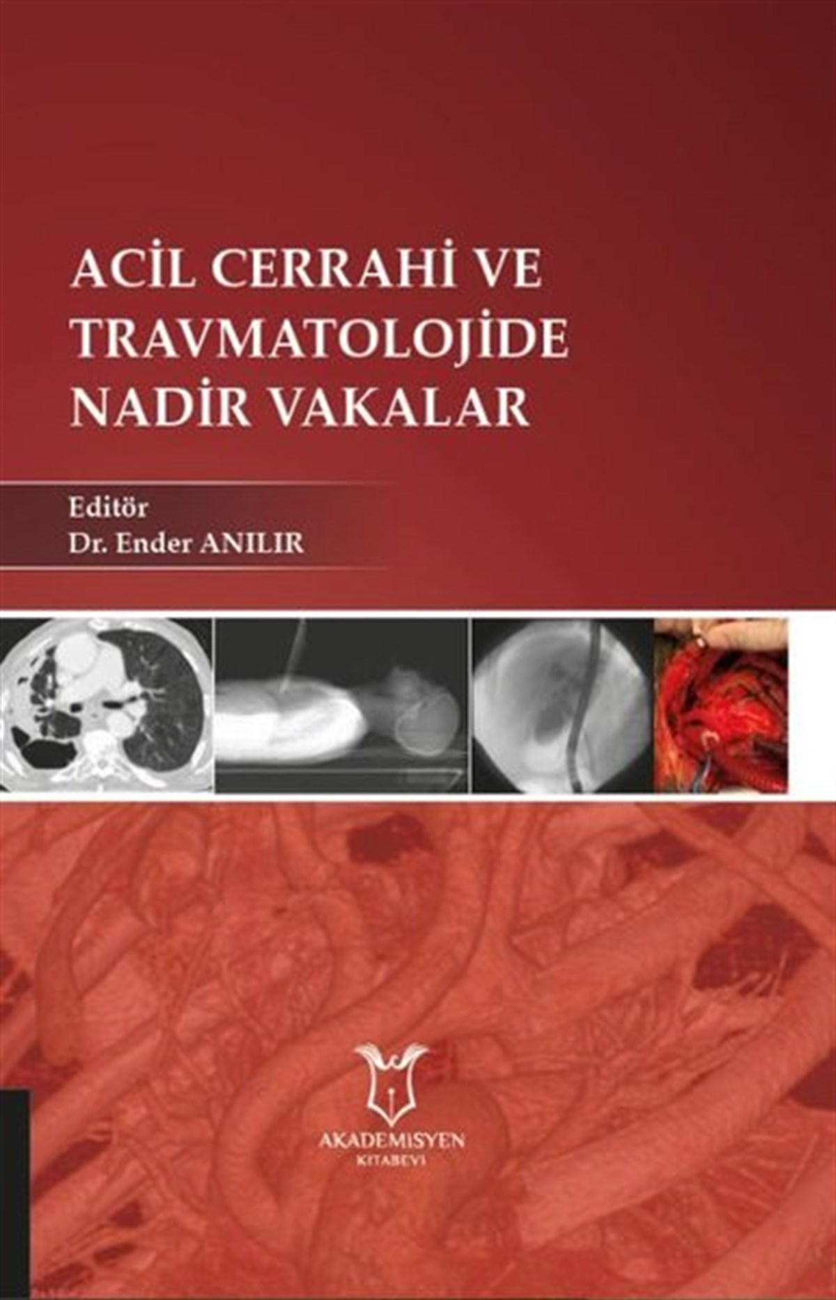 KolektifTıpAcil Cerrahi ve Travmatolojide Nadir Vakalar