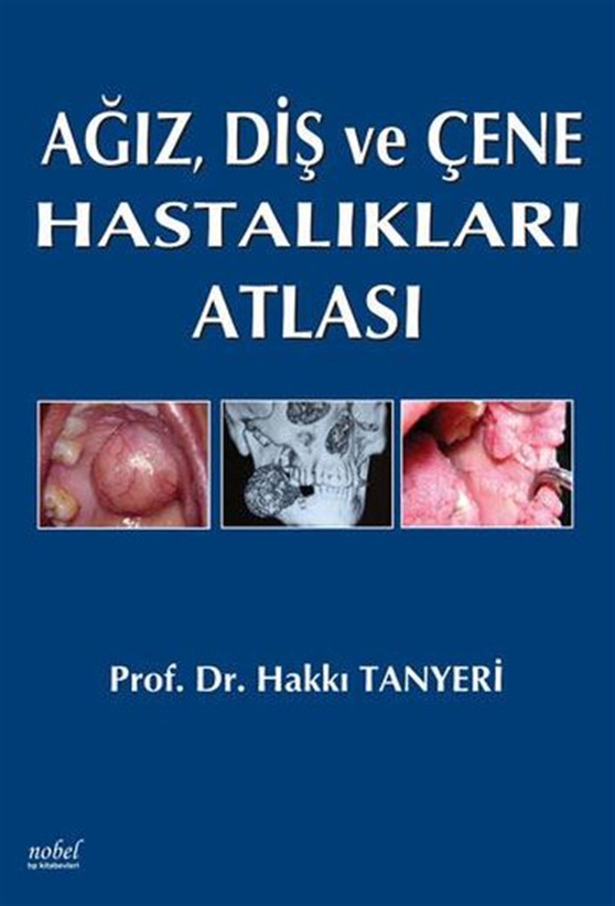 KolektifTıpAğız Diş ve Çene Hastalıkları Atlası