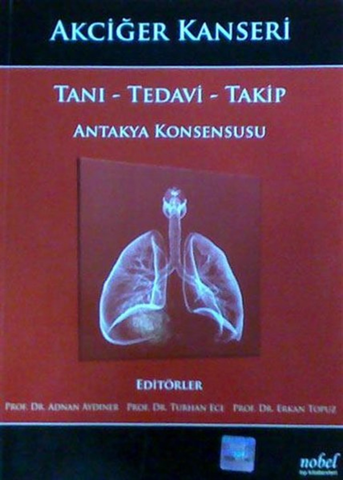 KolektifTıpAkciğer Kanseri Tanı - Tedavi-Takip Antakya Konsen.