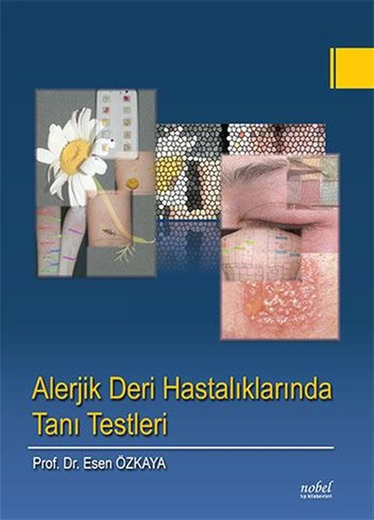 KolektifTıpAlerjik Deri Hastalıklarında Tanı Testleri