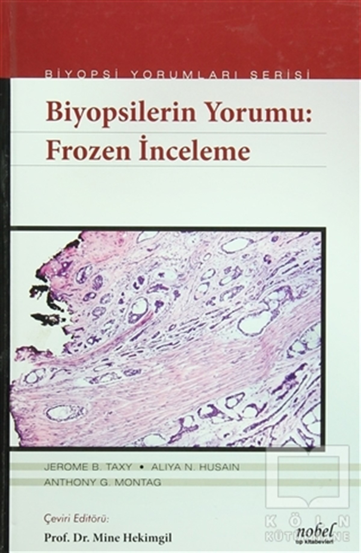 Jerome B. TaxyTıp BilimleriBiyopsilerin Yorumu: Frozen İnceleme