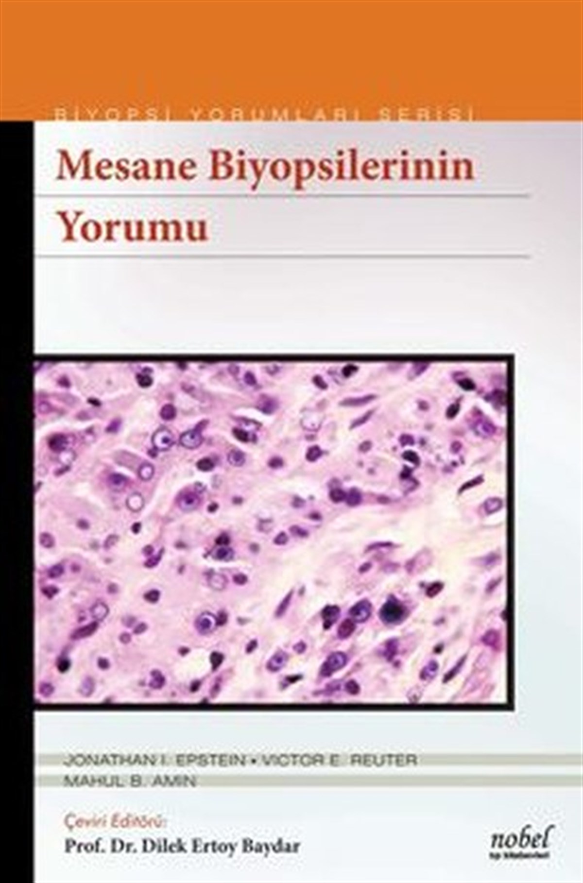 KolektifTıpBiyopsilerin Yorumu: Mesane