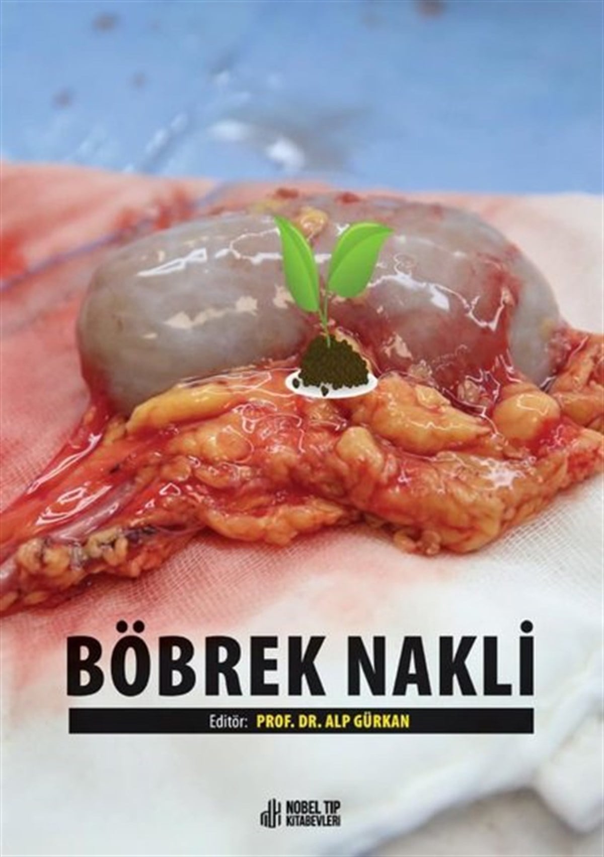 Alp GürkanTıpBöbrek Nakli