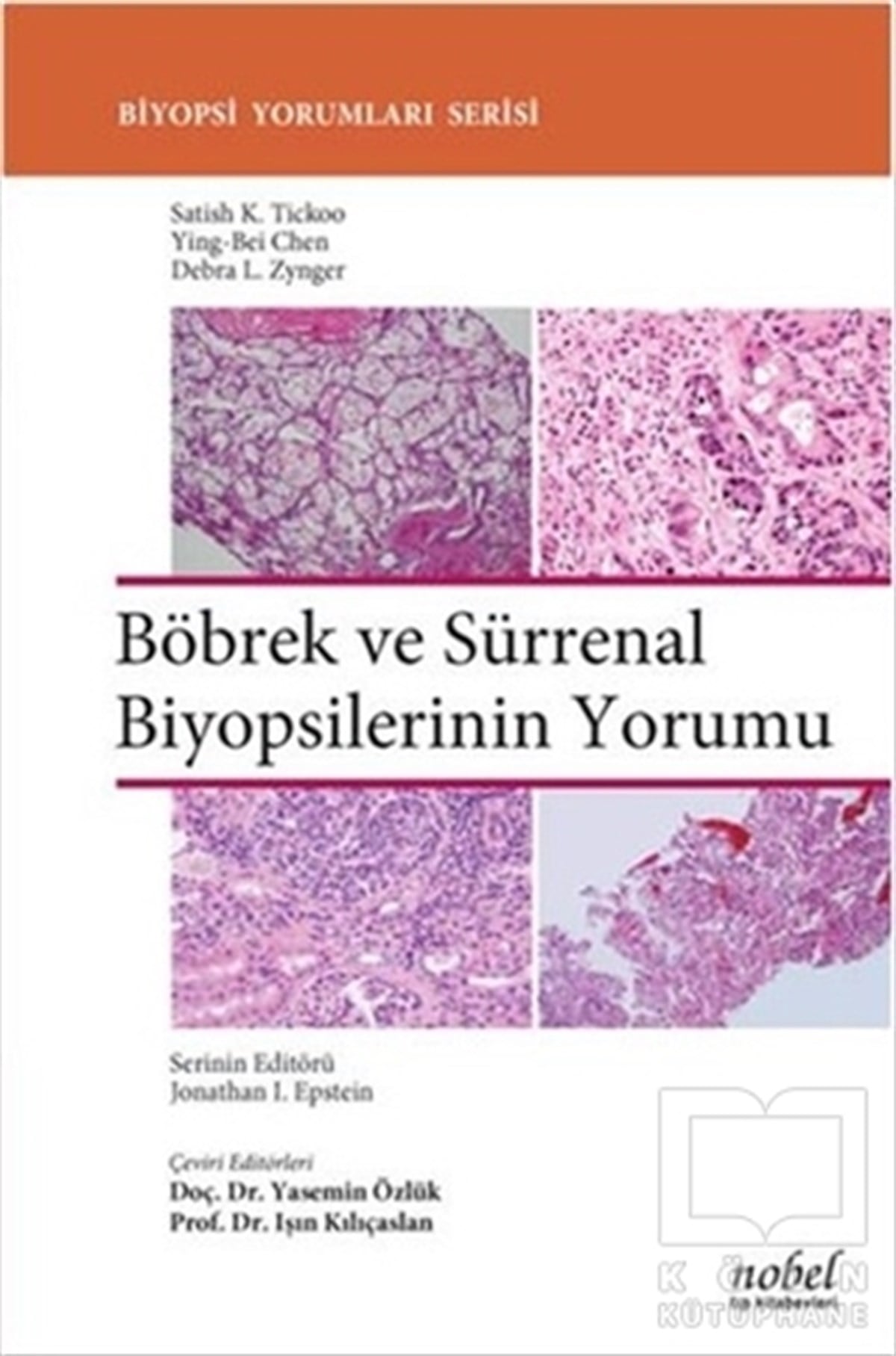 Satish K. TickooTıp BilimleriBöbrek ve Sürrenal Biyopsilerinin Yorumu