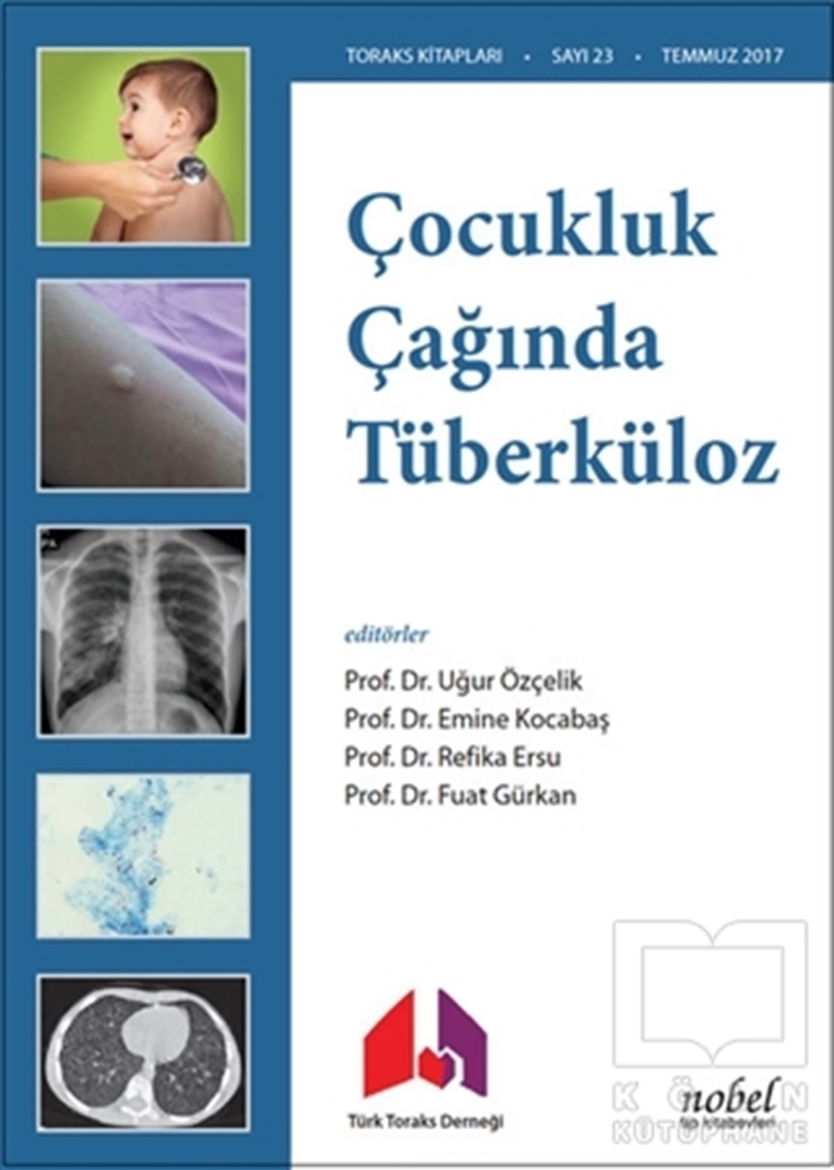 KolektifTıp BilimleriÇocukluk Çağında Tüberküloz