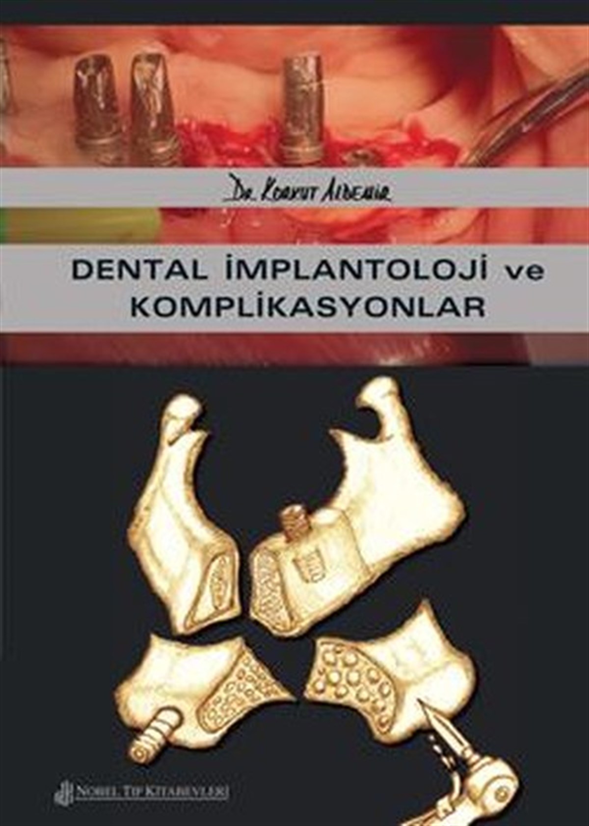 KolektifTıpDental İmplantoloji ve Komplikasyonlar