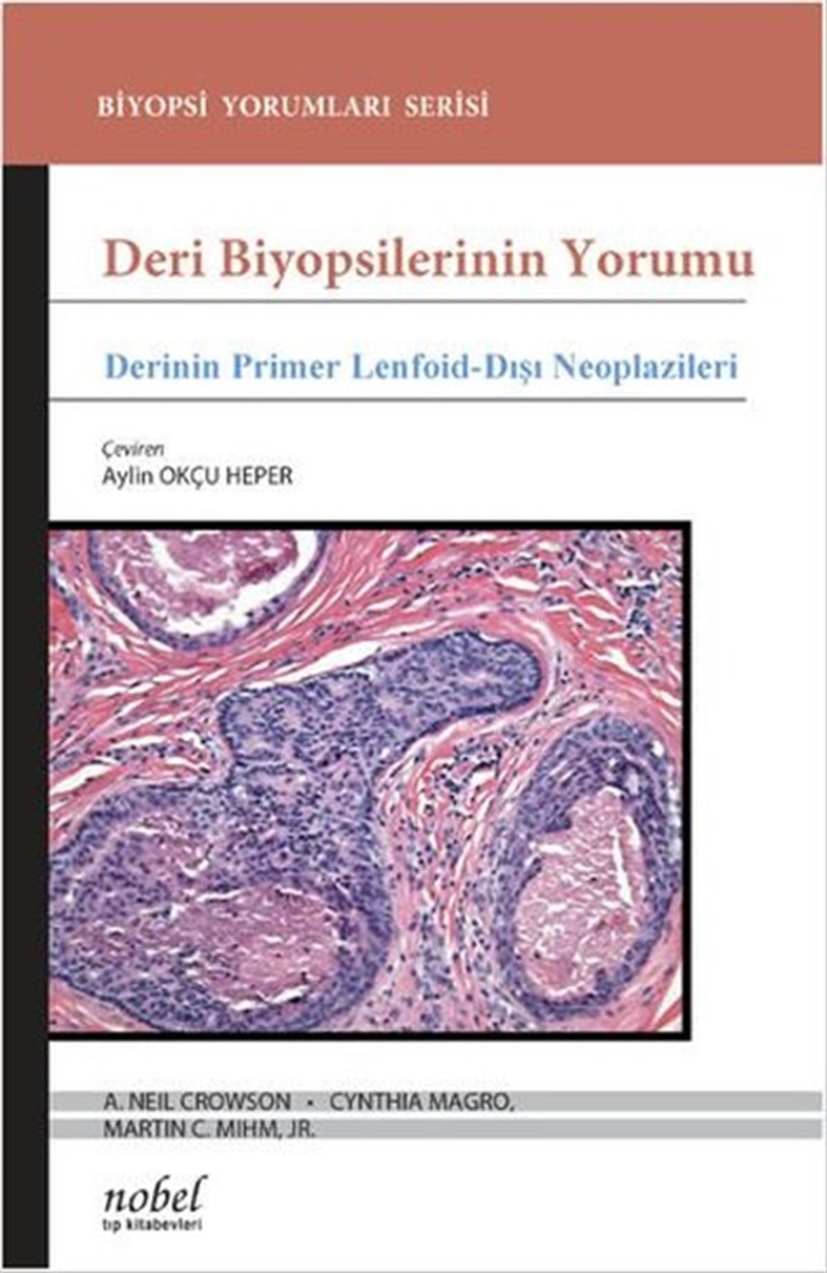 Martin C. Mihm Jr.TıpDeri Biyopsilerinin Yorumu