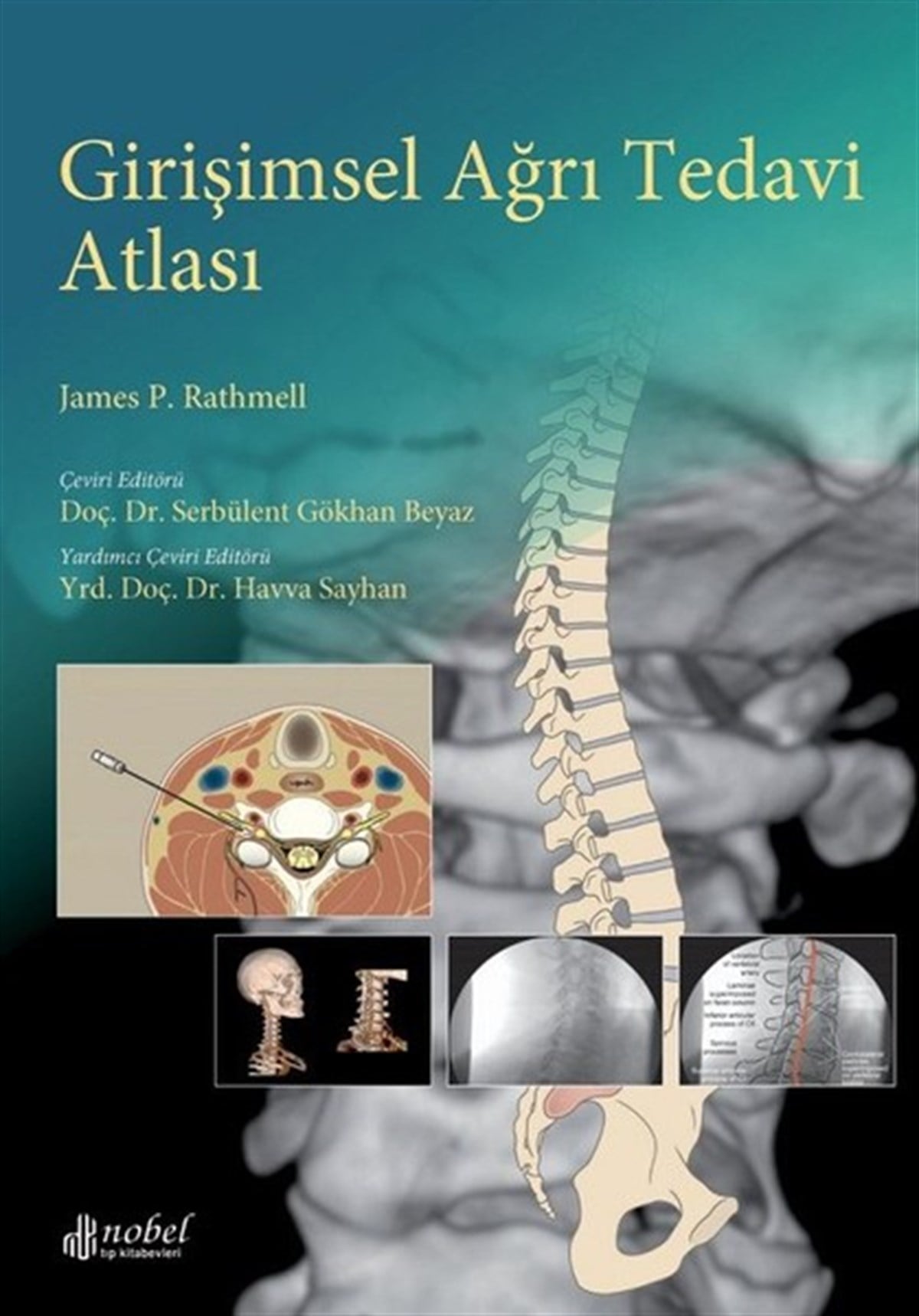 James P. RathmellTıpGirişimsel Ağrı Tedavi Atlası