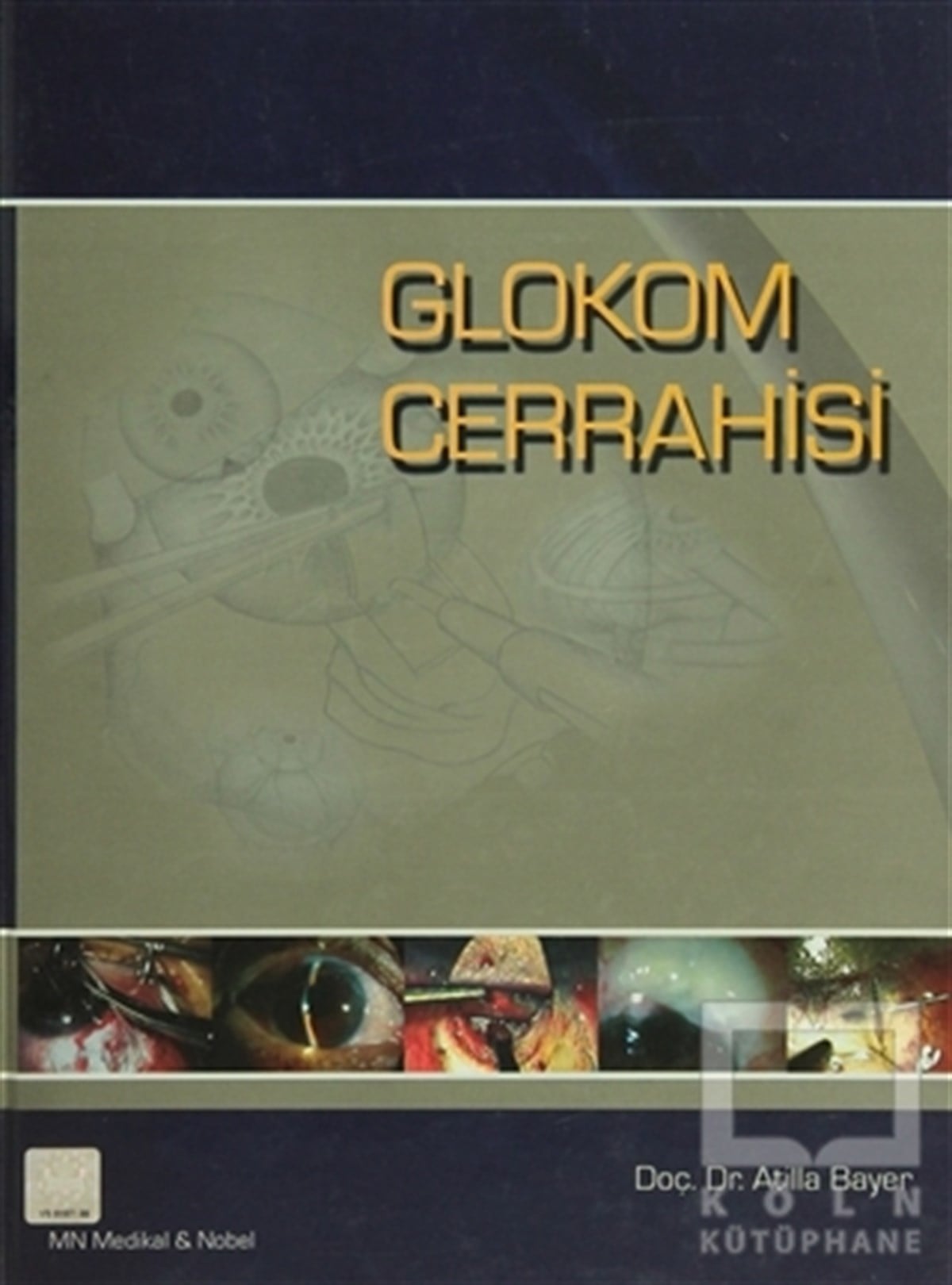 Atilla BayerAkademikGlokom Cerrahisi