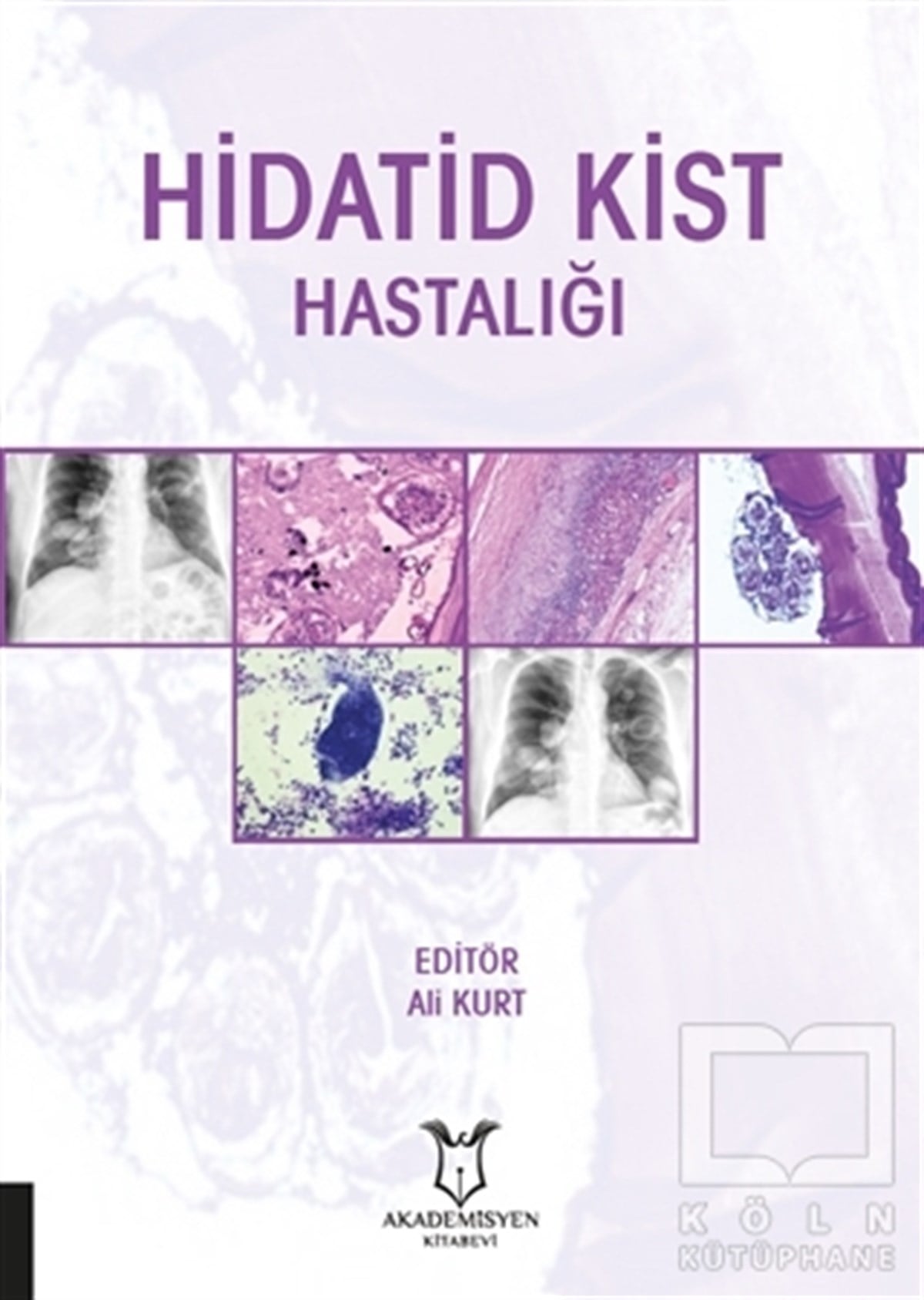 Ali KurtGenel Sağlık KitaplarıHidatid Kist Hastalığı