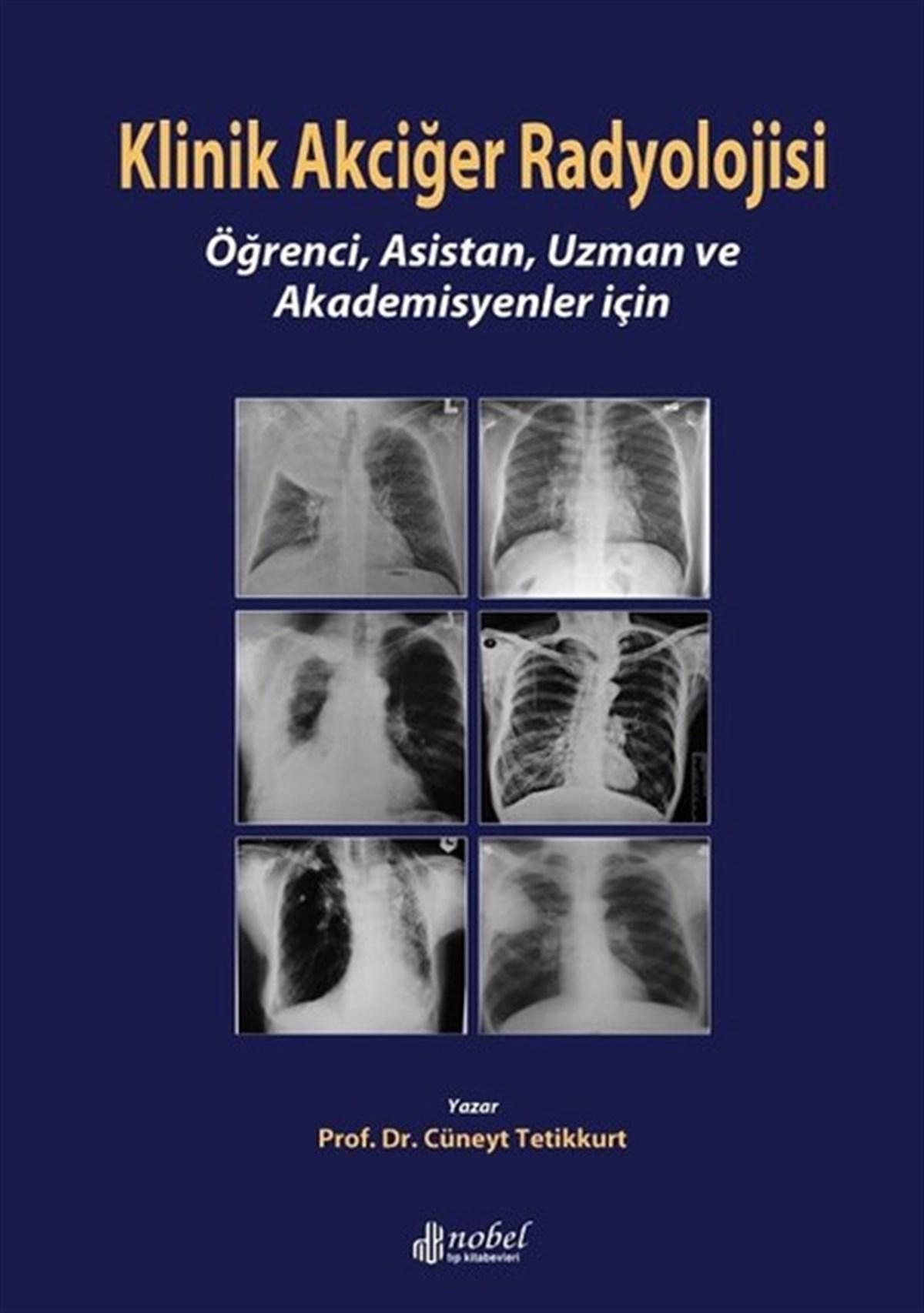 Prof.Dr. Cüneyt TetikkurtTıpKlinik Akciğer Radyolojisi