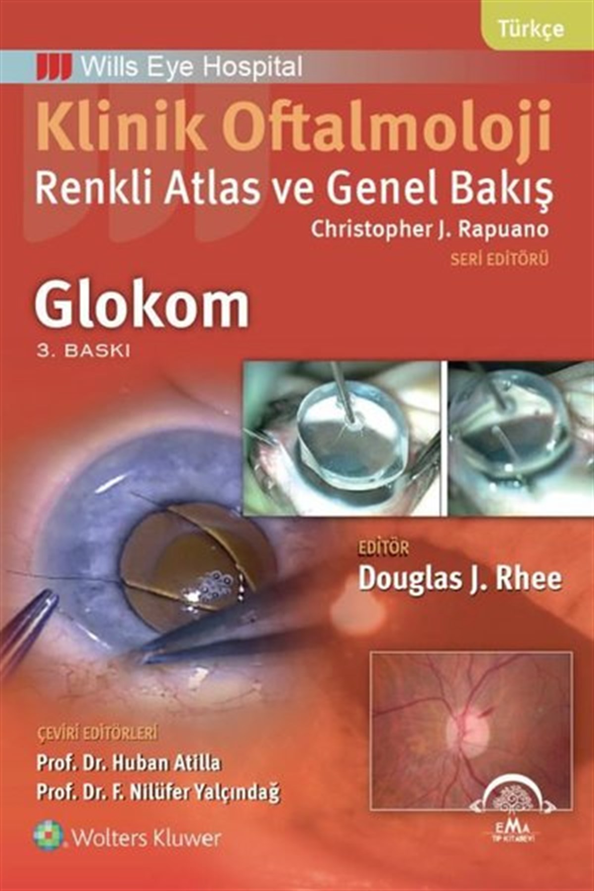 Huban AtillaTıpKlinik Oftalmoloji Renkli Atlas ve Genel Bakış Glokom