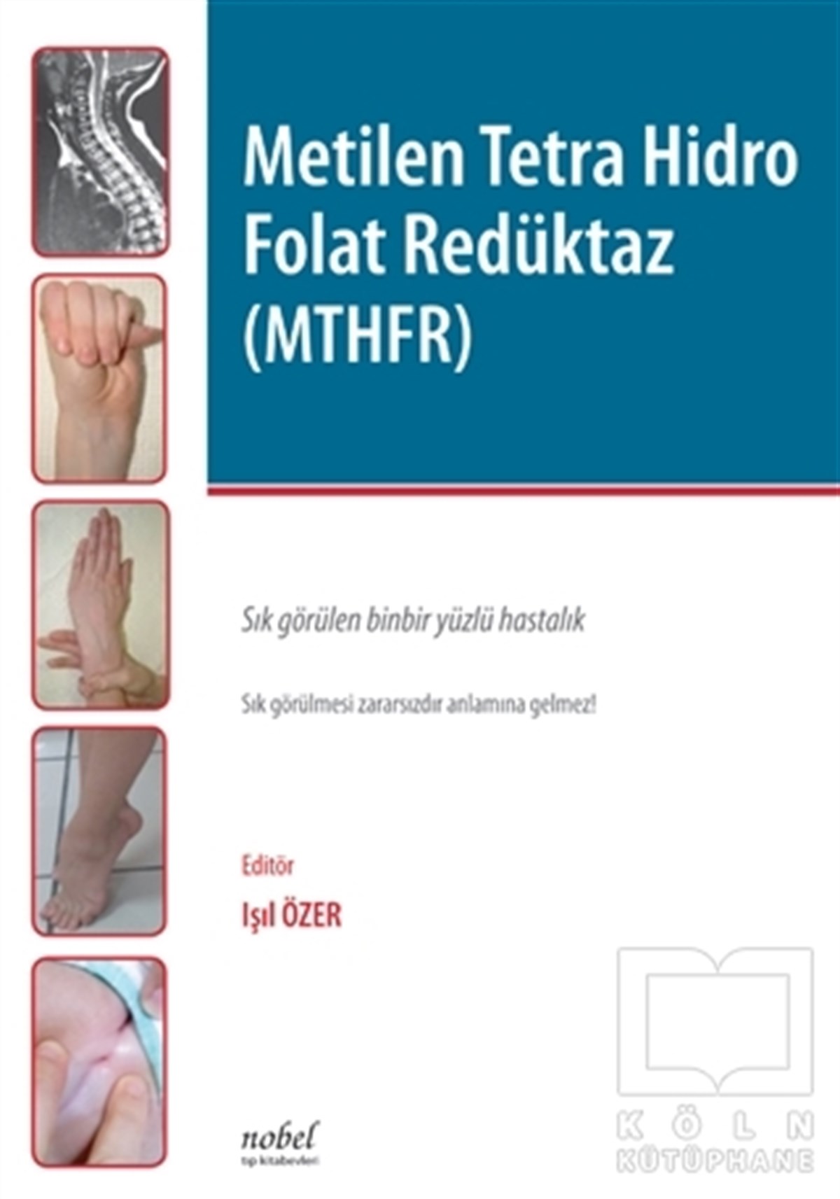 Işıl ÖzerTıp BilimleriMetilen Tetra Hidro Folat Redüktaz (MTHFR)