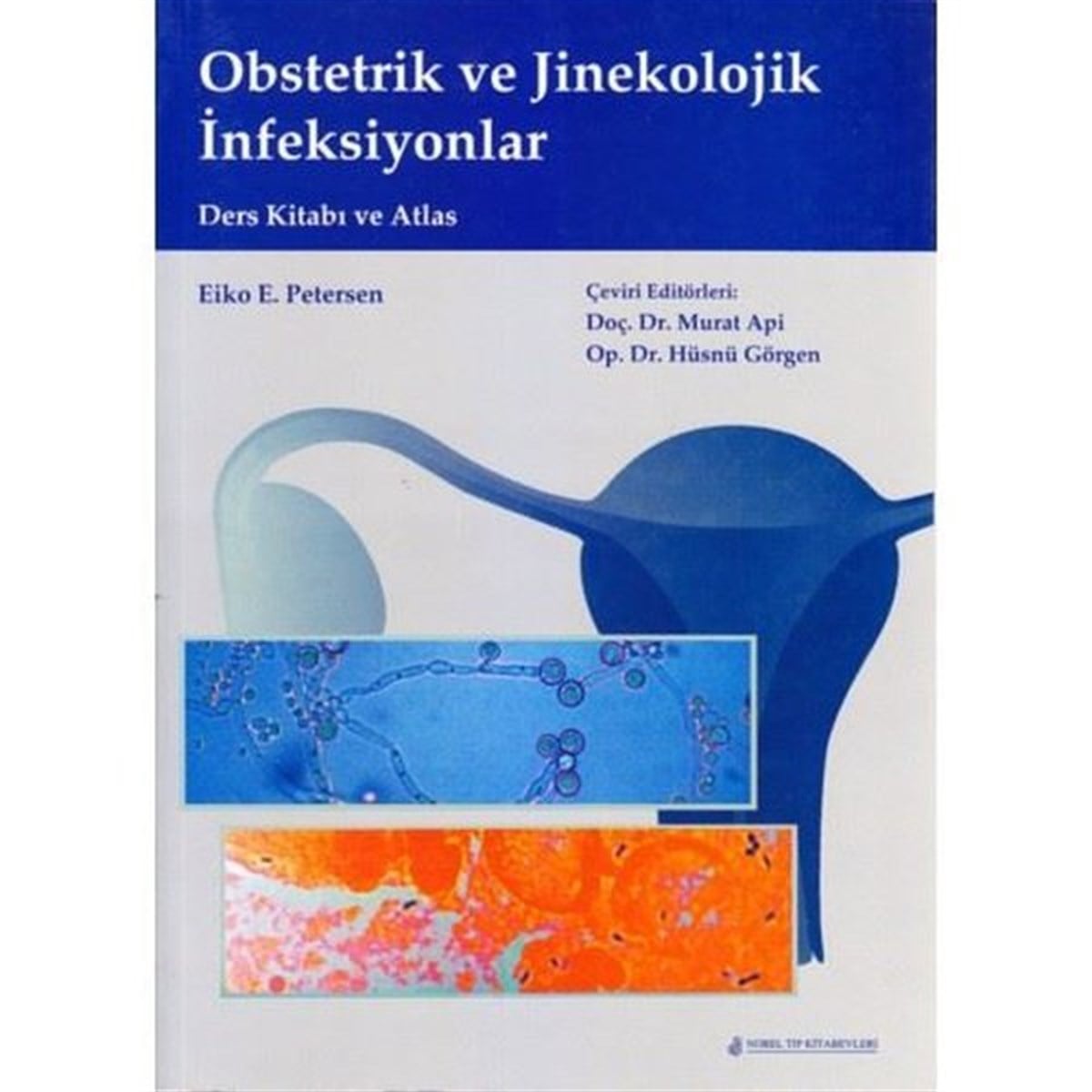 KolektifTıpObstetrik ve Jinekolojik İnfeksiyonlar