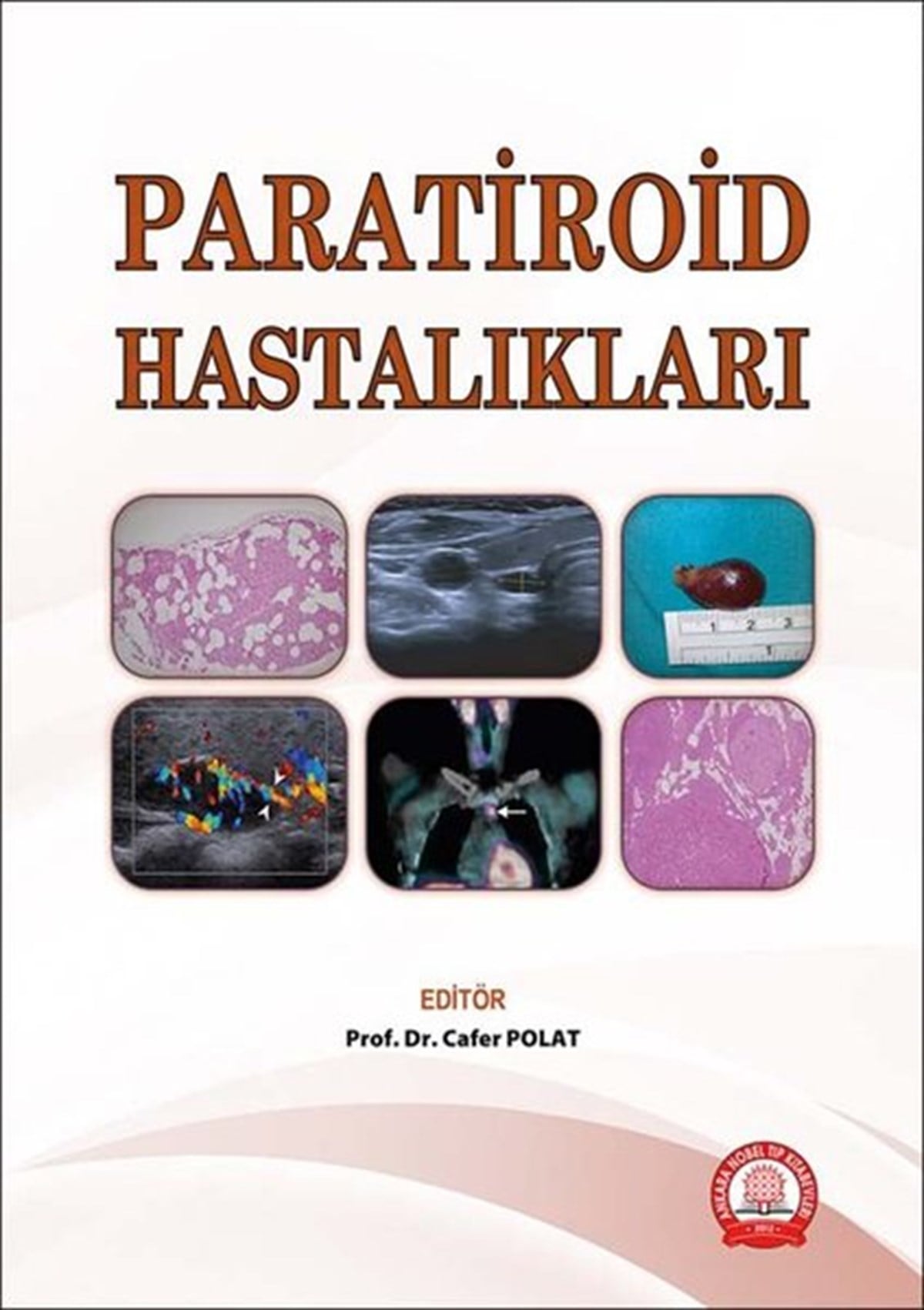 KolektifEğitimParatiroid Hastalıkları
