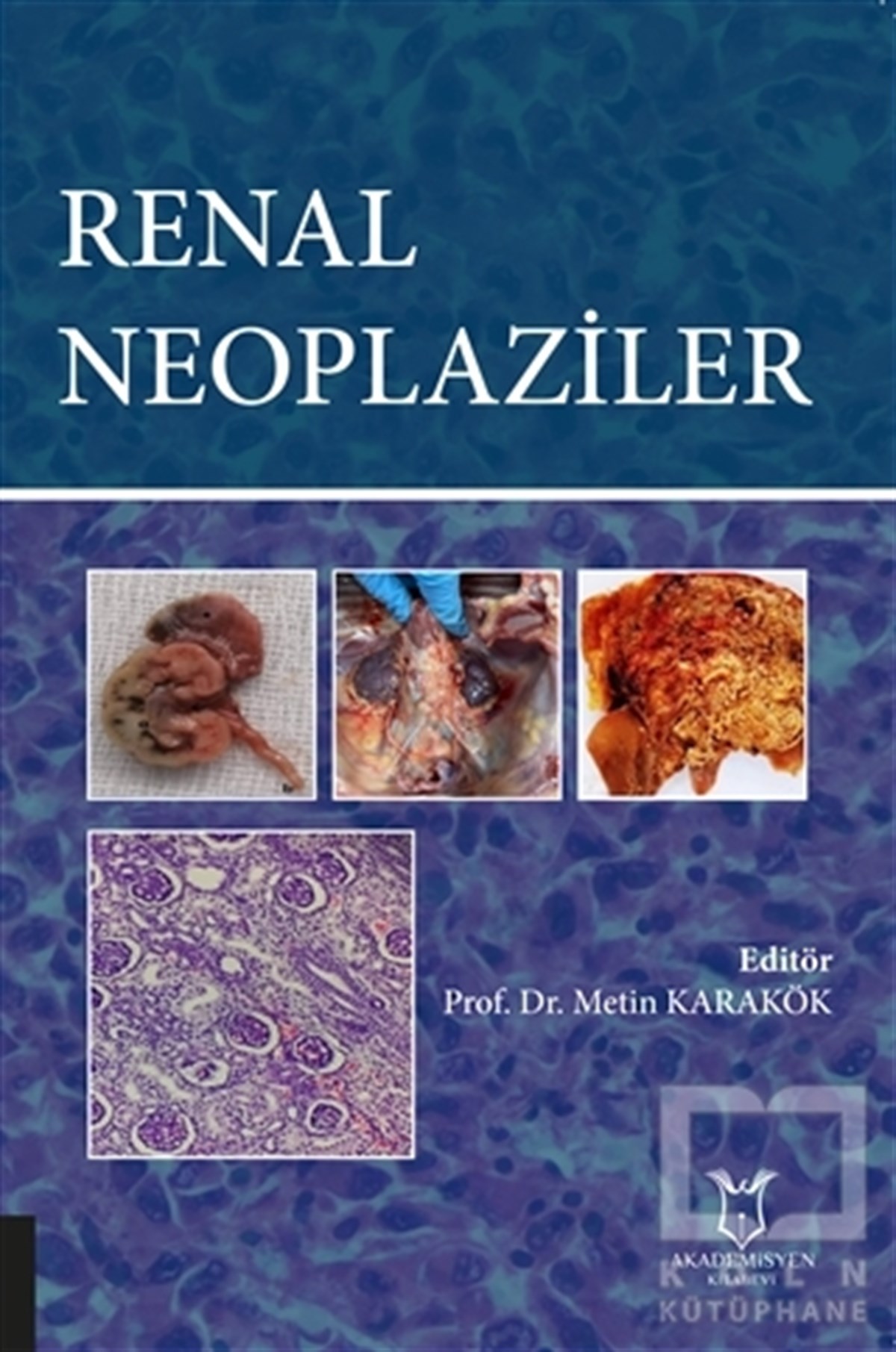 KolektifDiğerRenal Neoplaziler