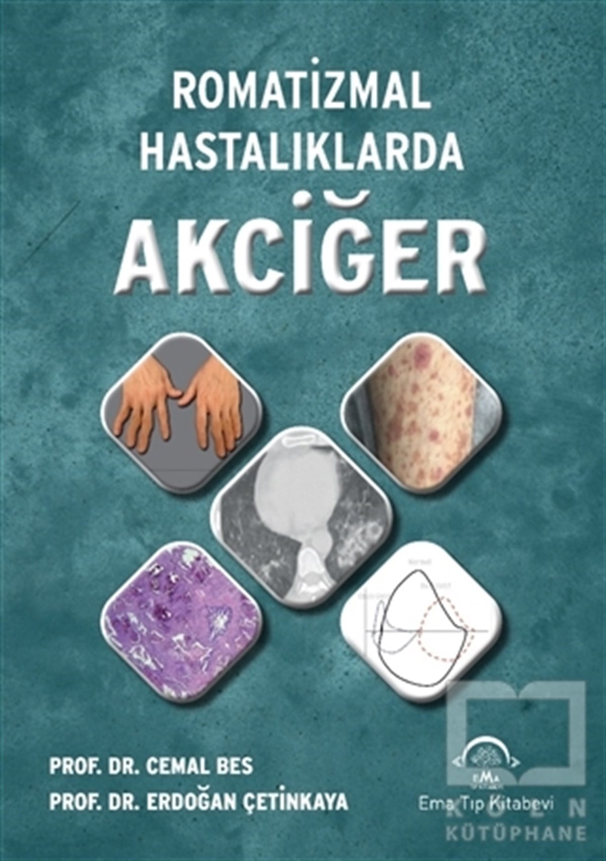 Cemal BesTıp Bilimleri KitaplarıRomatizmal Hastalıklarda Akciğer
