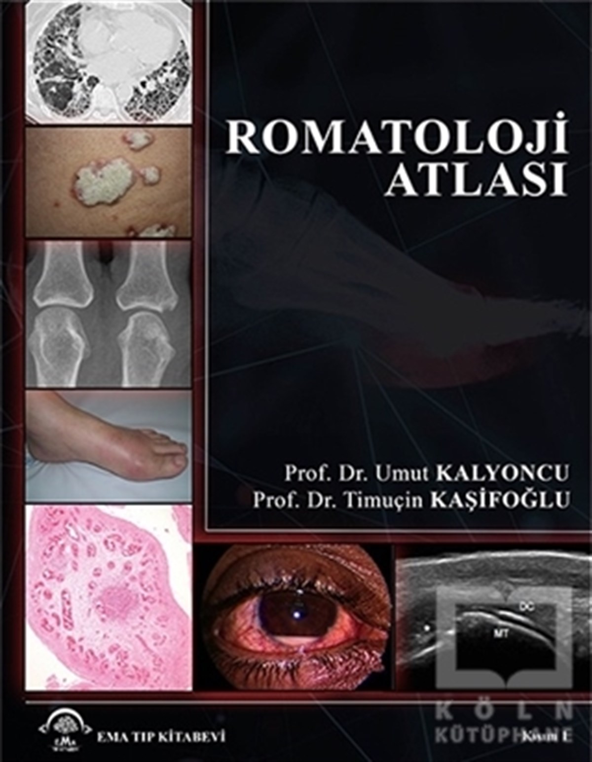 Umut KalyoncuBaşvuru KitaplarıRomatoloji Atlası
