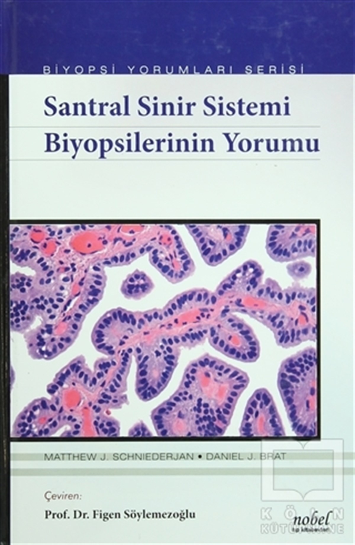 Matthew J. SchniederjanTıp BilimleriSantral Sinir Sistemi Biyopsilerinin Yorumu