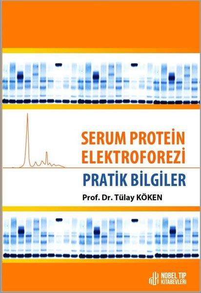 Tülay KökenDigerSerum Protein Elektroforezi - Pratik Bilgiler