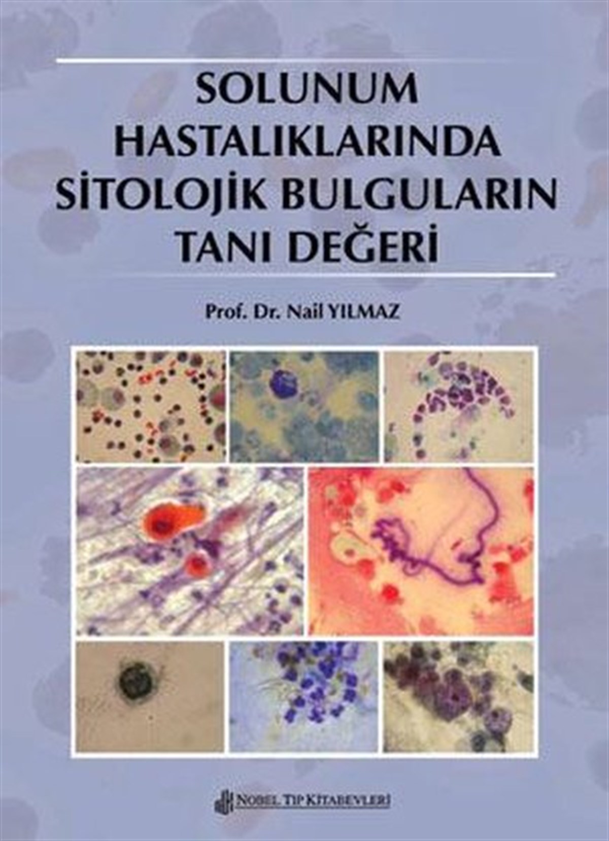 KolektifTıpSolunum Hastalıklarında Sitolojik Bulguların Tanı Değeri