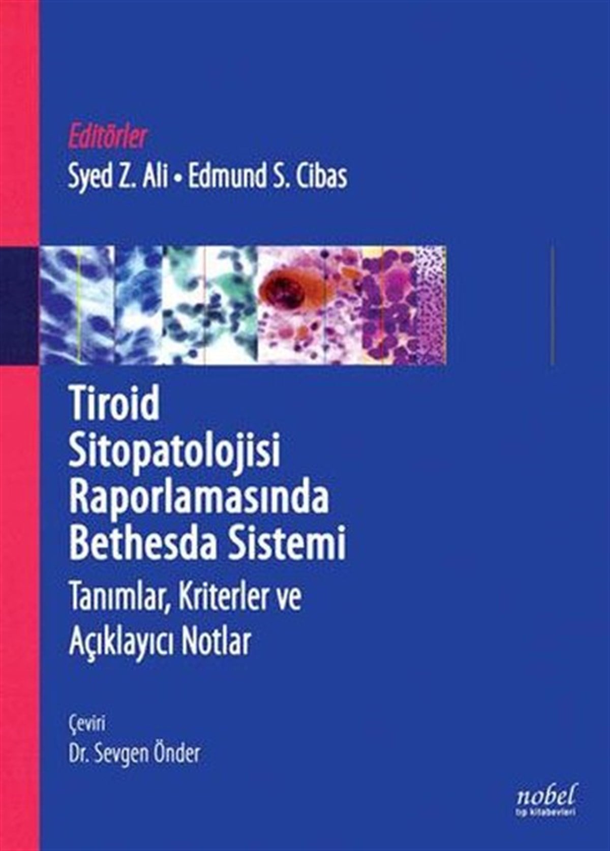 KolektifTıpTiroid Sitopatolojisi Raporlamasında Bedhesda Sistemi