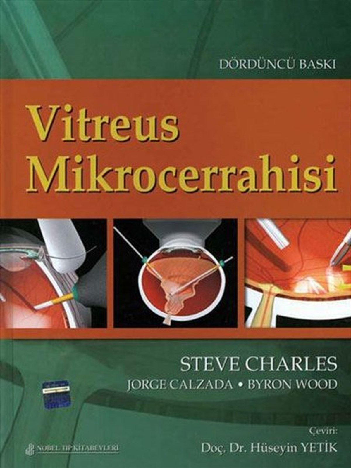 KolektifTıpVitreus Mikrocerrahisi