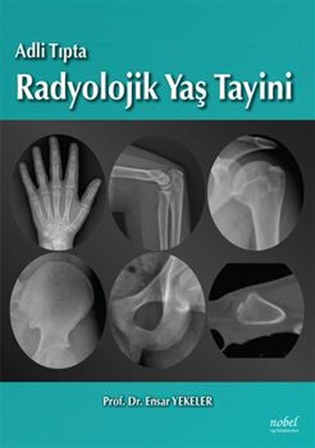 KolektifTıpAdli Tıpta Radyolojik Yaş Tayini