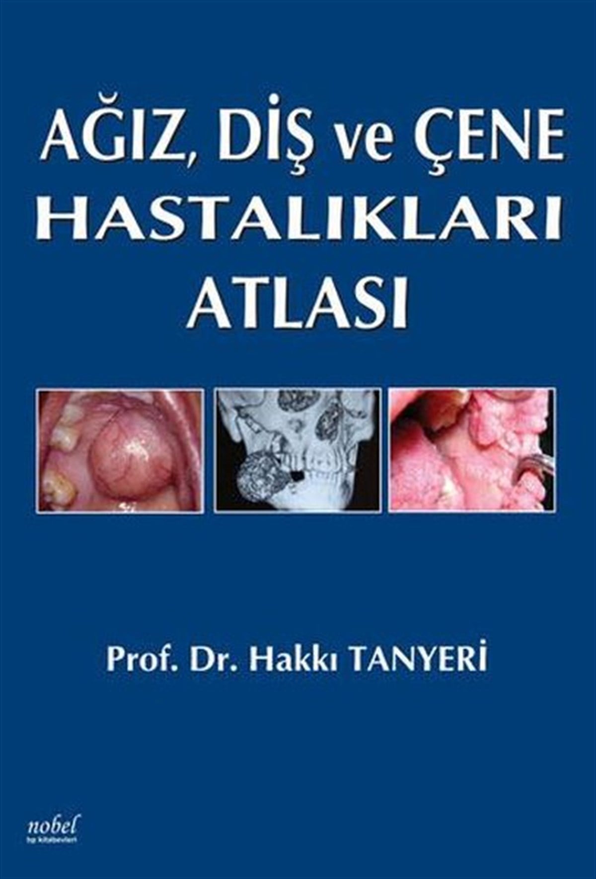 KolektifTıpAğız Diş ve Çene Hastalıkları Atlası