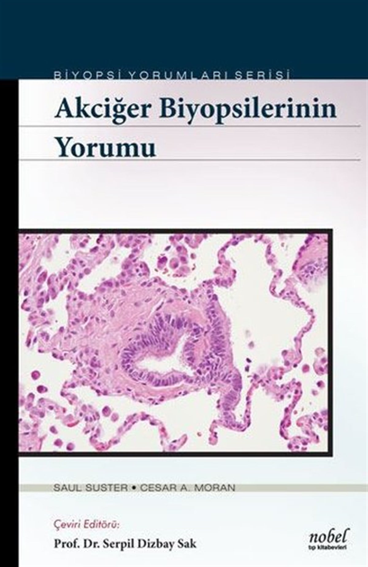 KolektifTıpBiyopsilerin Yorumu: Akciğer